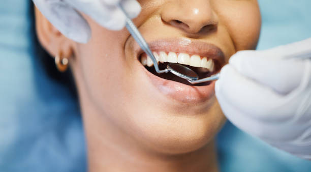 Best Emergency Tooth Extraction in Way, NE